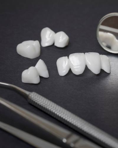 Several white dental crowns and veneers on table next to dental mirrors