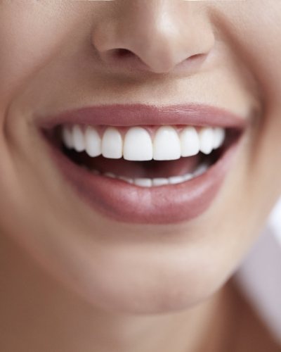 Close up of person smiling with straight white teeth