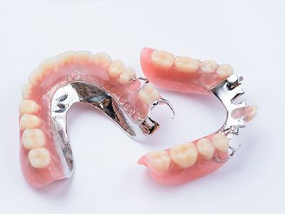 Two partial dentures with metal attachments