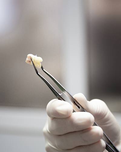 Dentist holding an extracted tooth
