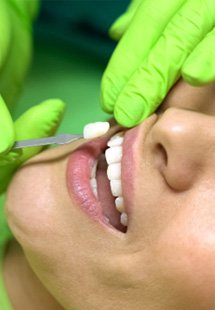 Woman getting veneers