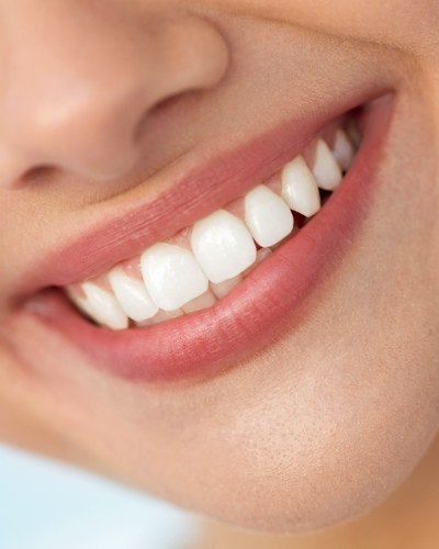 Close up of smile with straight white teeth