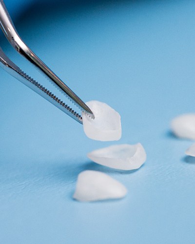 Set of veneers on a table