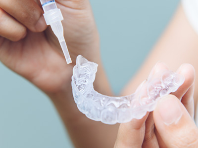 Patient in Mississauga talking to dentist about teeth whitening