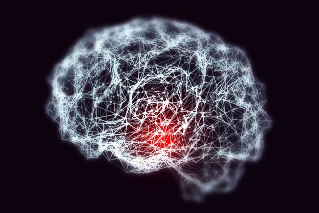 Diagram of a brain